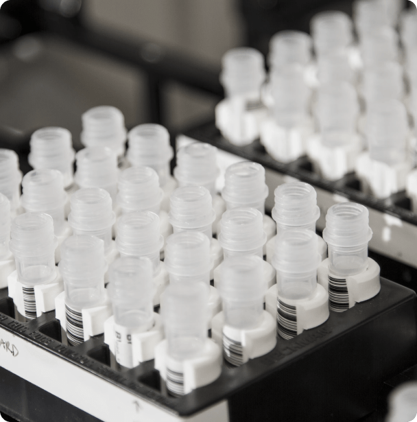 Close-up of clear plastic laboratory sample vials with barcode labels organized in testing racks
